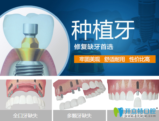牙齒缺失說話漏風？德陽新橋口腔種植牙幫你改善缺牙問題