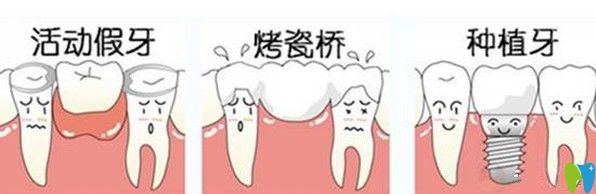 種植牙與其他修復(fù)技術(shù)相比更具優(yōu)勢(shì)