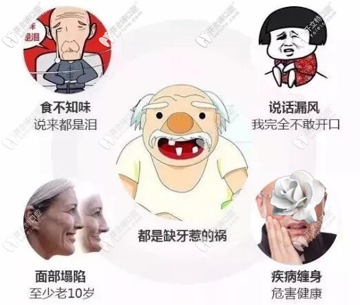 ?？邶埲A鼎點(diǎn)口腔劉文彤醫(yī)生介紹牙齒缺失的危害有哪些