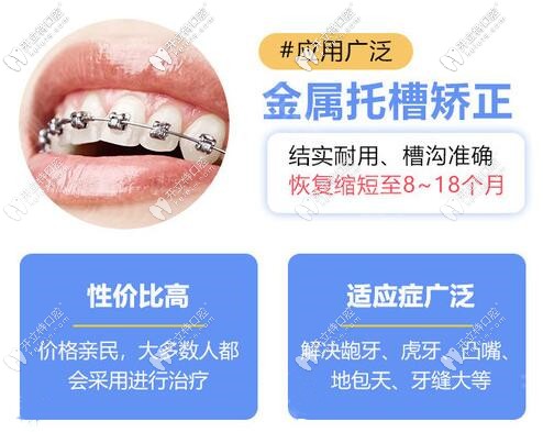 蘇州金屬托槽牙齒矯正價(jià)格