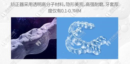 comfos隱形牙套優(yōu)勢
