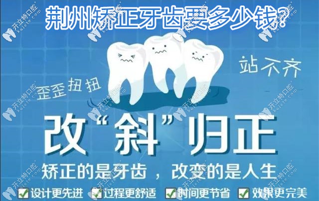 荊州牙齒矯正收費(fèi)價(jià)格表已出,附荊州整牙好的醫(yī)院名單