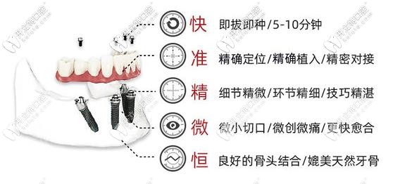 即刻種植、即刻負(fù)重技術(shù)優(yōu)勢(shì)