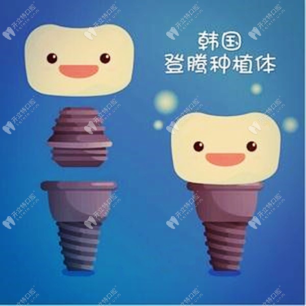 昆明做韓國純鈦登騰種植牙補貼價2399元一顆，也太便宜了吧